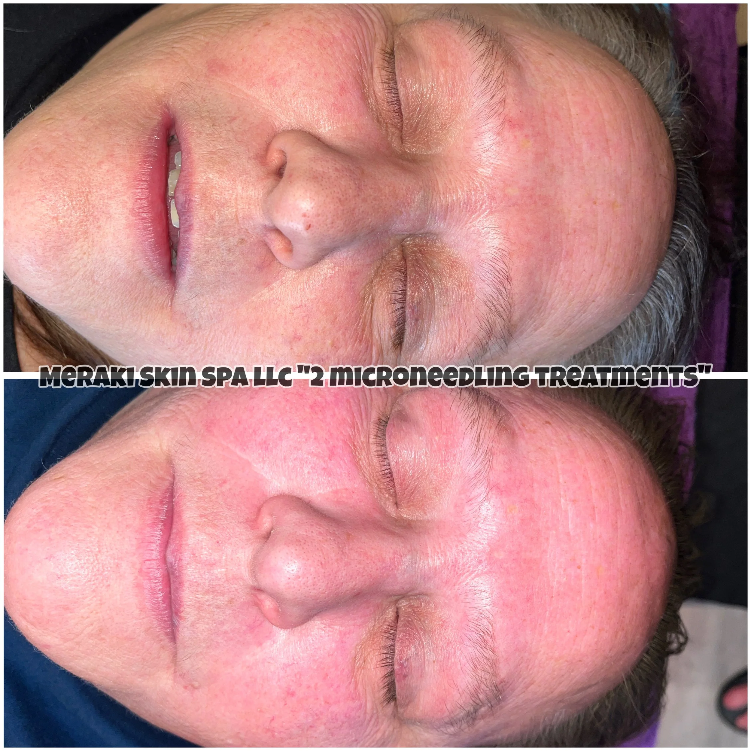 Meridian Idaho-day spa-med spa-skin care treatment-corrective facials-permanent makeup- tattooed eyeliner-micro blading-eyelash extensions-micro needling-chemical peels-lash lift-brow lamination-Eagle Idaho-Boise Idaho-PCA Skin-Esthetician near me