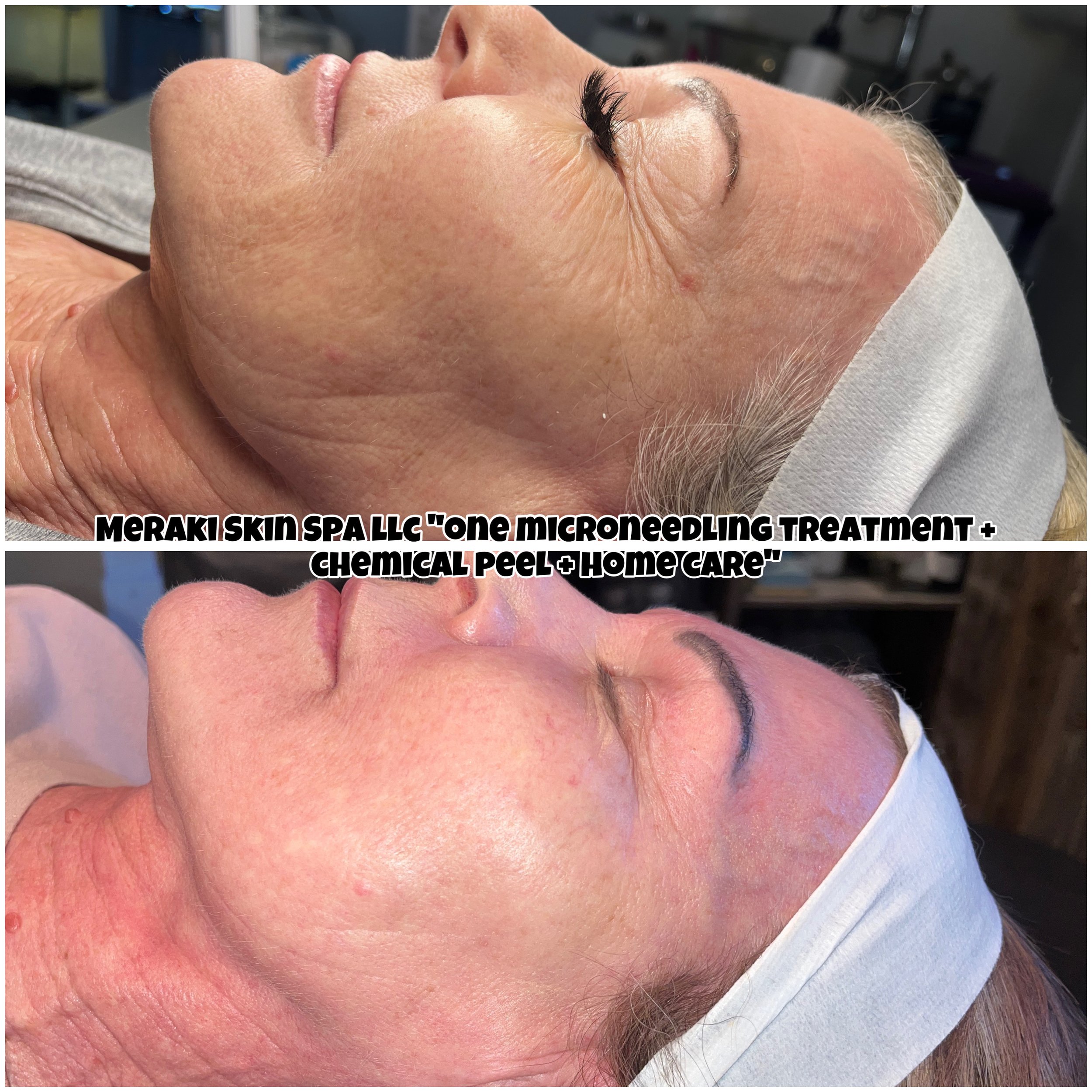 Meridian Idaho-day spa-med spa-skin care treatment-corrective facials-permanent makeup- tattooed eyeliner-micro blading-eyelash extensions-micro needling-chemical peels-lash lift-brow lamination-Eagle Idaho-Boise Idaho-PCA Skin-Esthetician near me