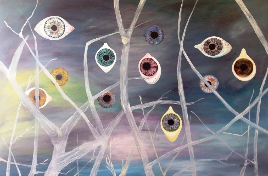Eye Floaters