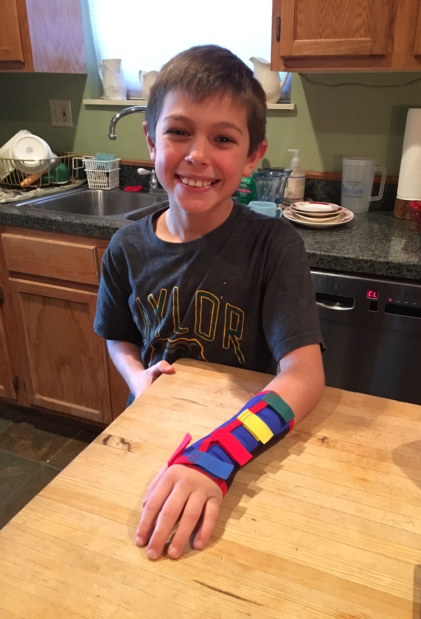 my son showing his cast