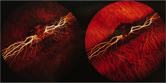 Diagnostic Imaging: "Thunderbolt Anatomy" Petr Soukup