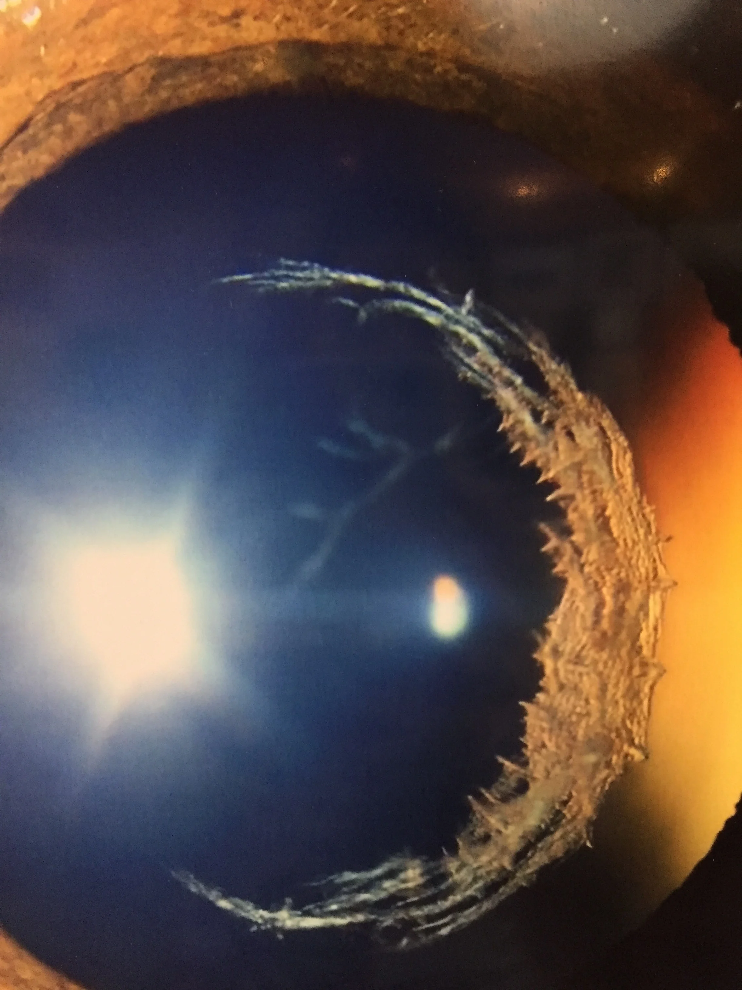 Anterior Segment winner: Cherlene Delgado, “Celestial Eye”