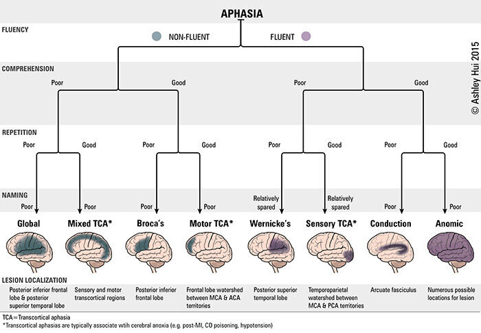 HUI_ClassificationofAphasia.jpg