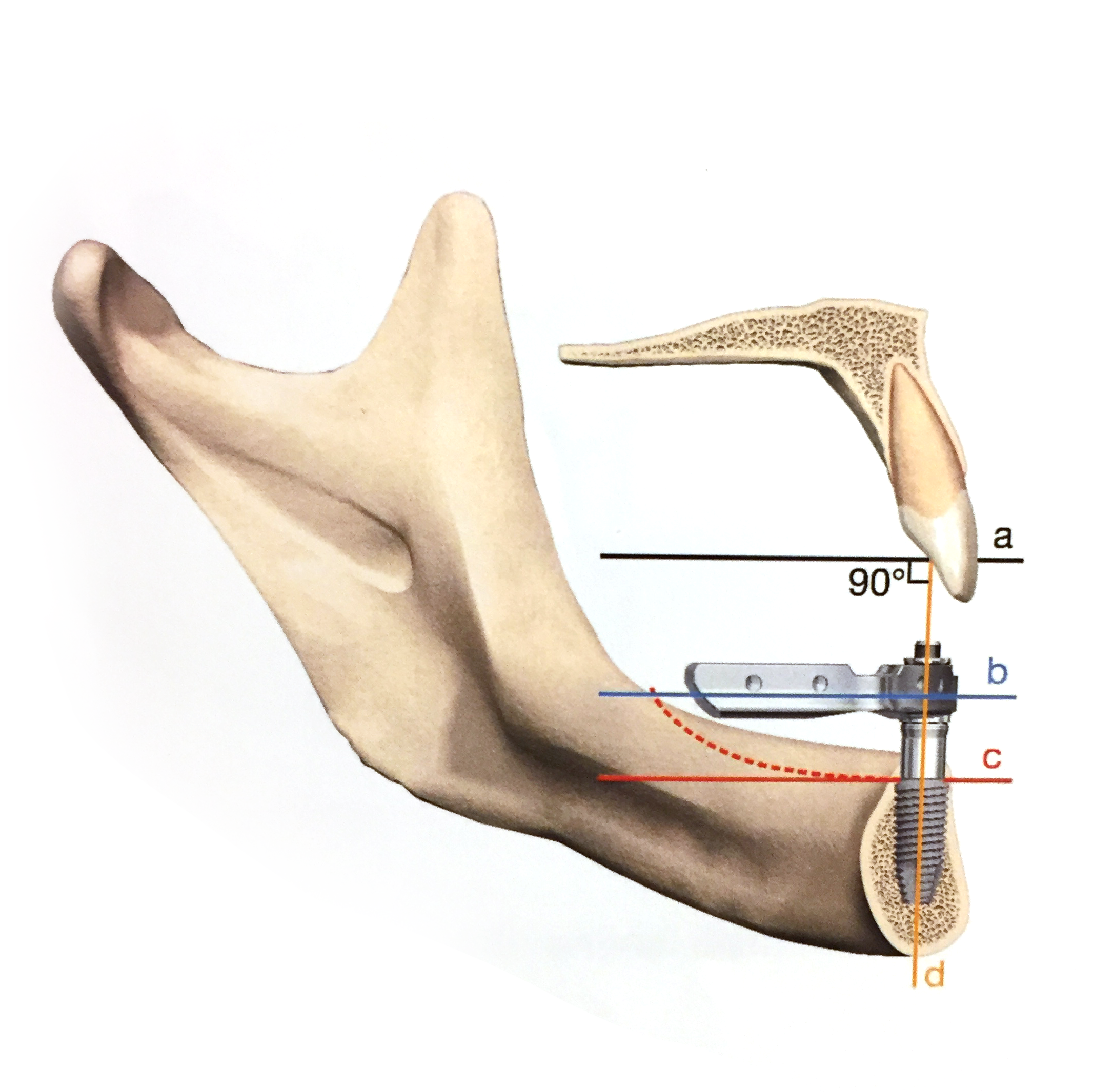 Trefoil-Anatomical-Considerations.png