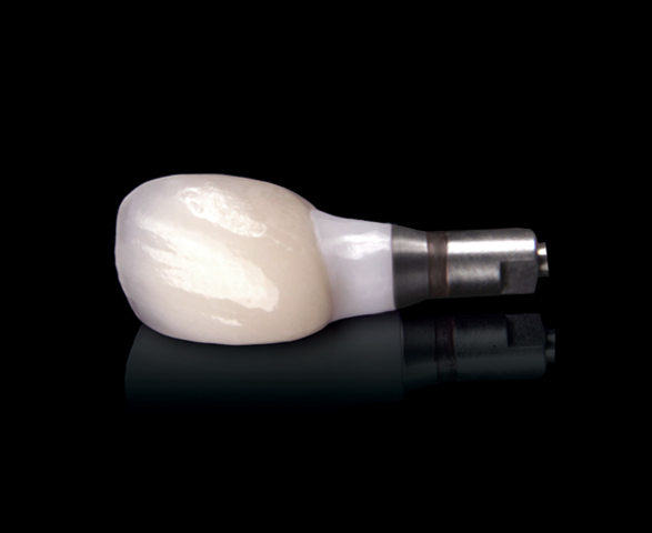 IMPLANT RESTORATIONS