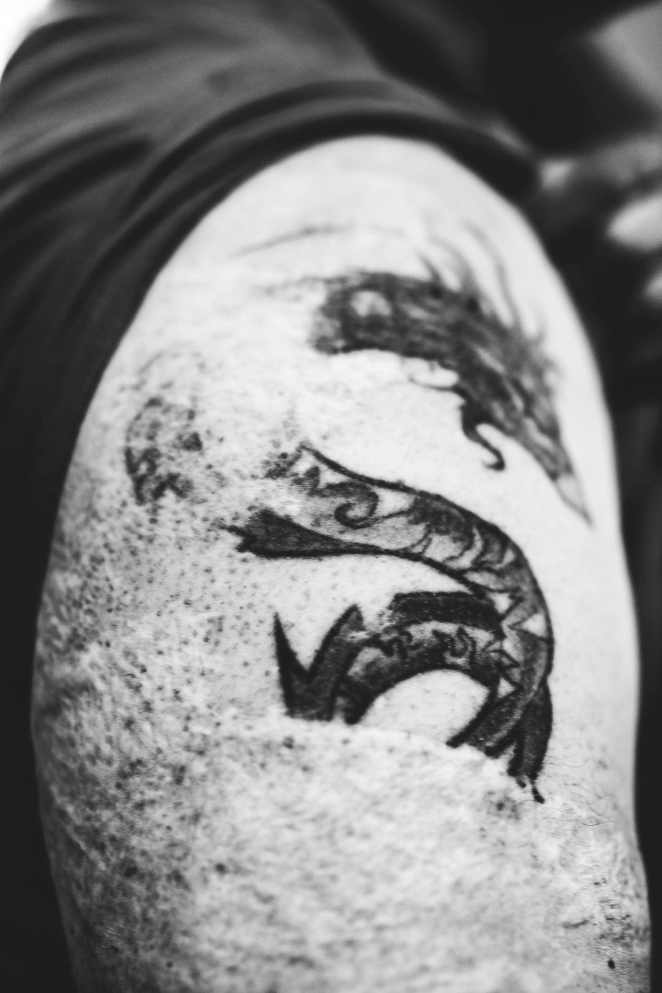 These are Joe's injuries that he sustained while in Iraq. He sustained 3rd degree burns on 40-50% of his body.