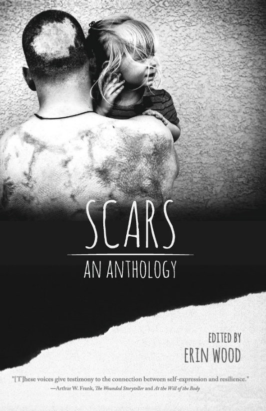 SCARS FRONT COVER FOR SITE.PNG
