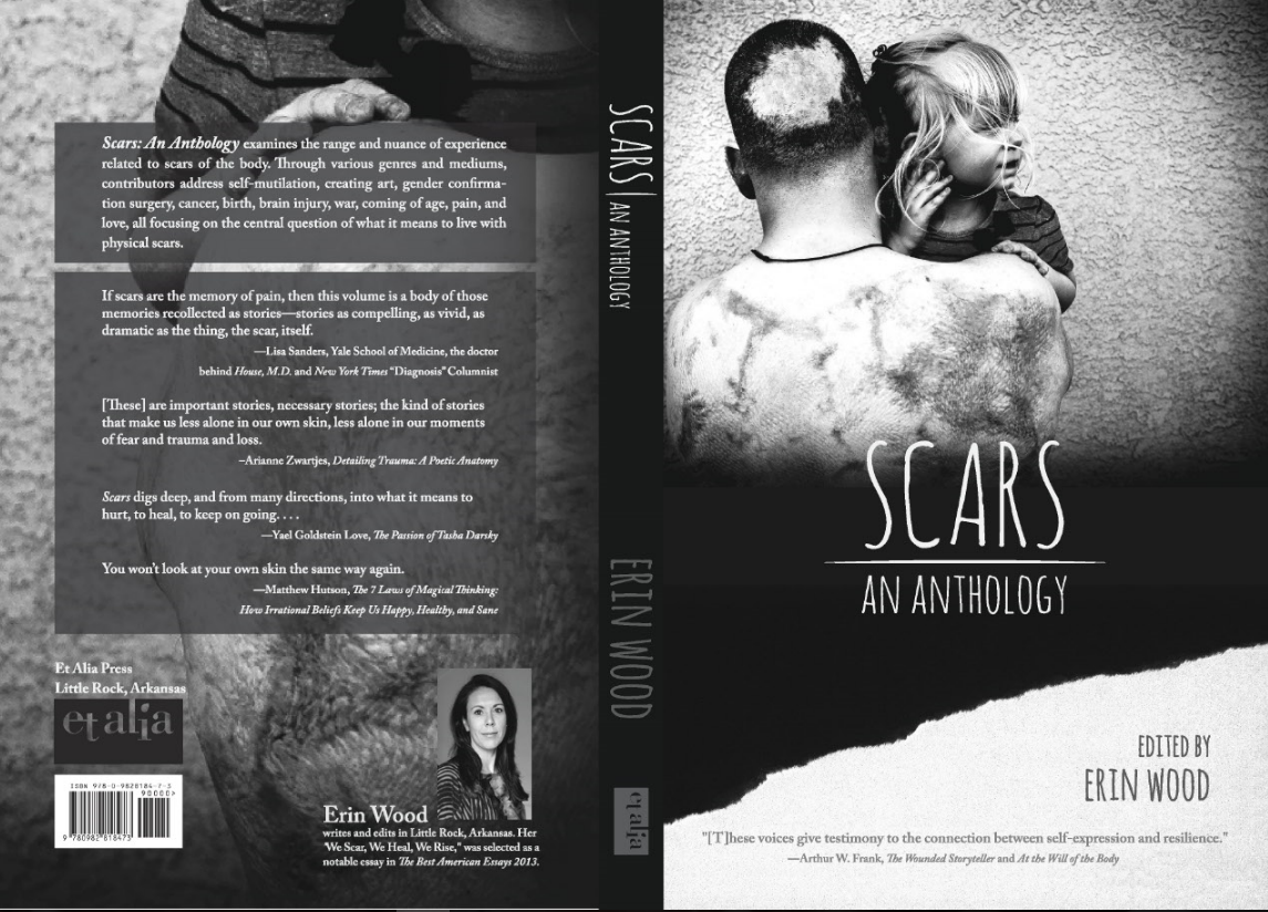 SCARS FRONT and BACK COVER FOR SITE.PNG