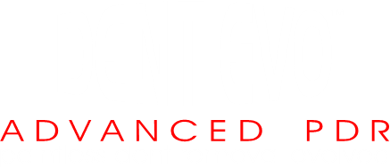 Dent Evo Car Dent Removal
