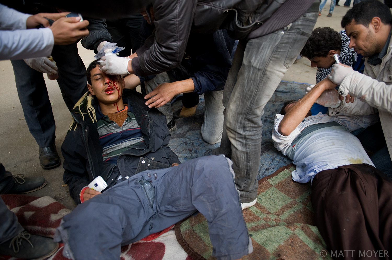  An Egyptian protester is assisted at a makeshift field hospital after being injured in clashes with government forces in Cairo, Egypt. 
