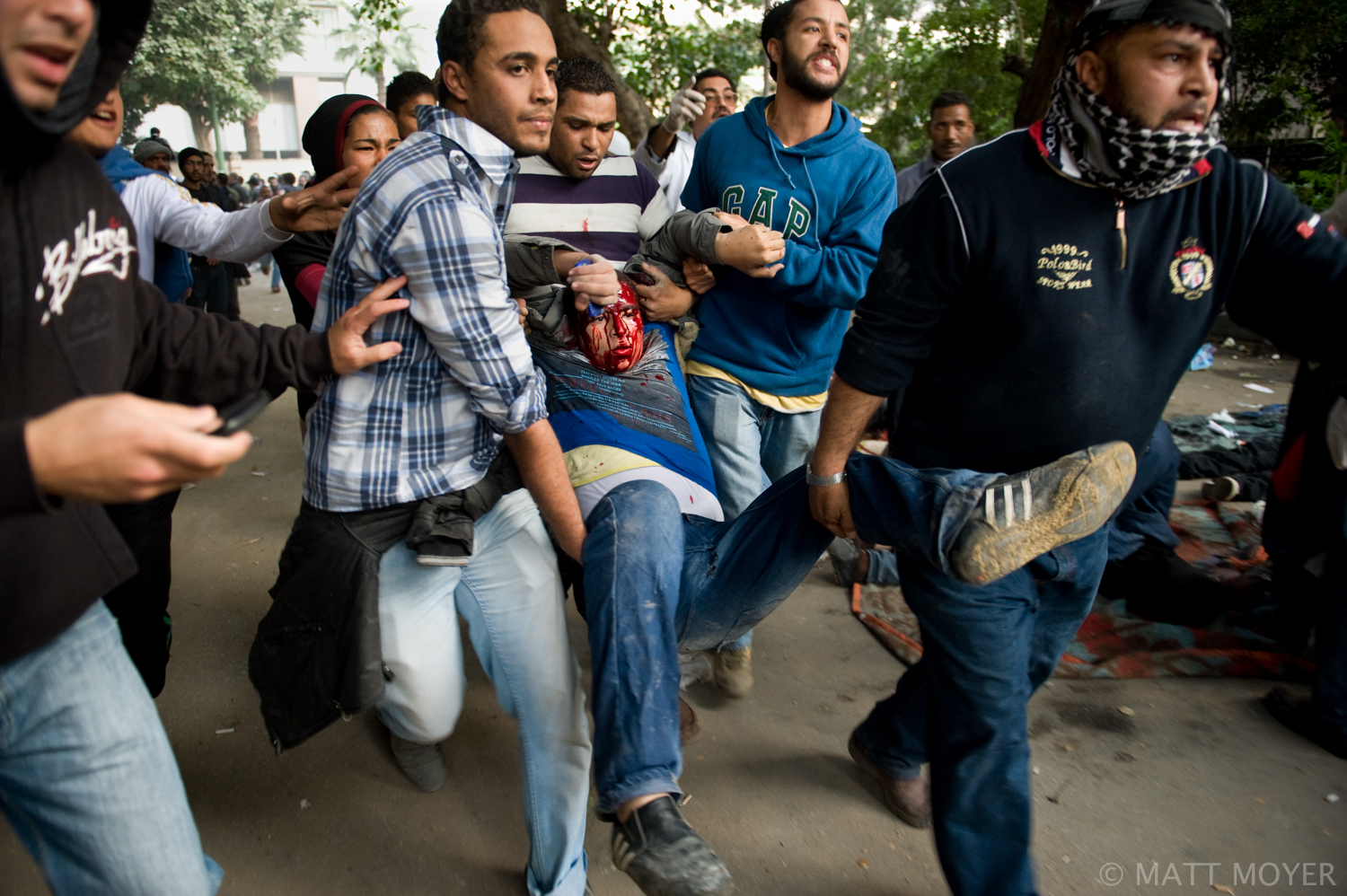  An Egyptian protester is rushed to a makeshift field hospital after being injured in clashes with government forces in Cairo, Egypt. 