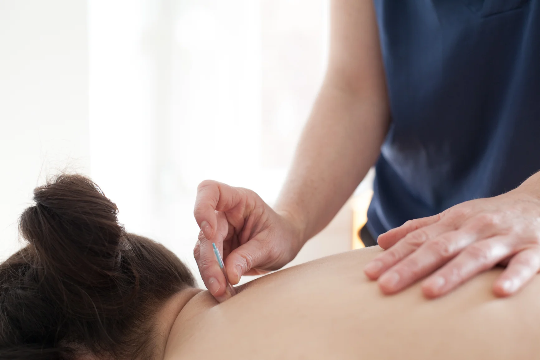 Renee Pilgrim Accupuncture-3.jpg