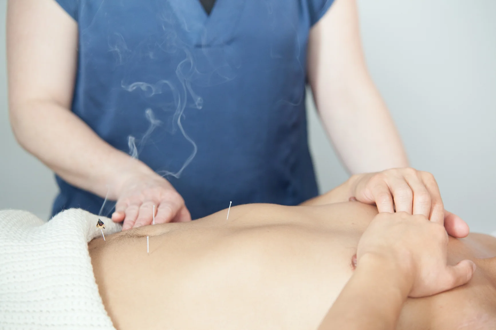 Moxibustion.jpg