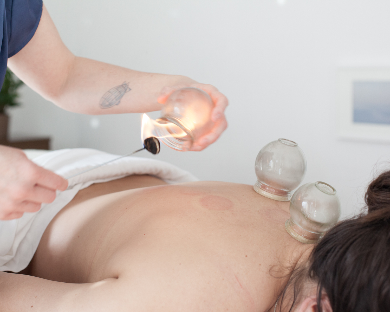 Renee+Pilgrim+Fire+Cupping-2.jpg