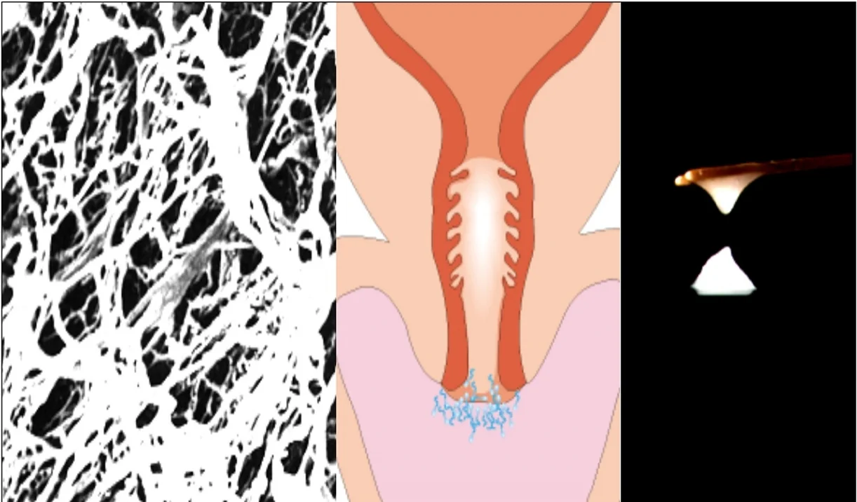 Copyright © Cecilia Pyper and Jane Knight in collaboration with FertilityUK and the Institute for Reproductive Health, Georgetown University 2003. 