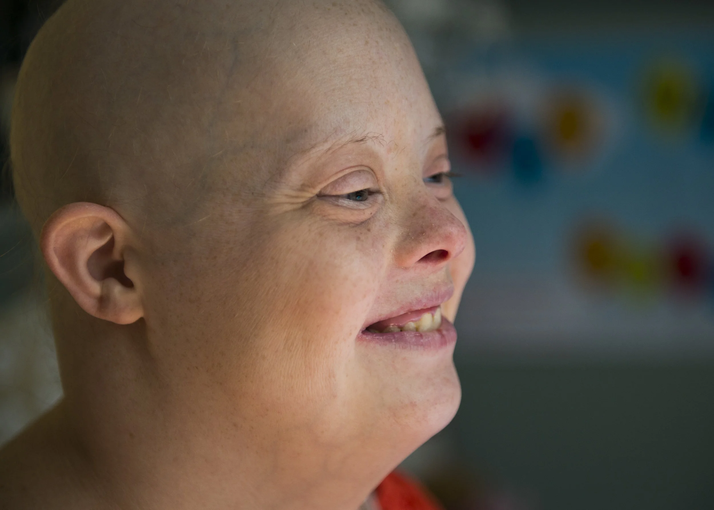  Katies Hildreth smiles while resting in her bedroom at home. In March, Katie was diagnosed with Stage 4 Hodgkins Lymphoma. She has been in chemotherapy for 4 months, but no longer has any more active cancer cells.&nbsp; 