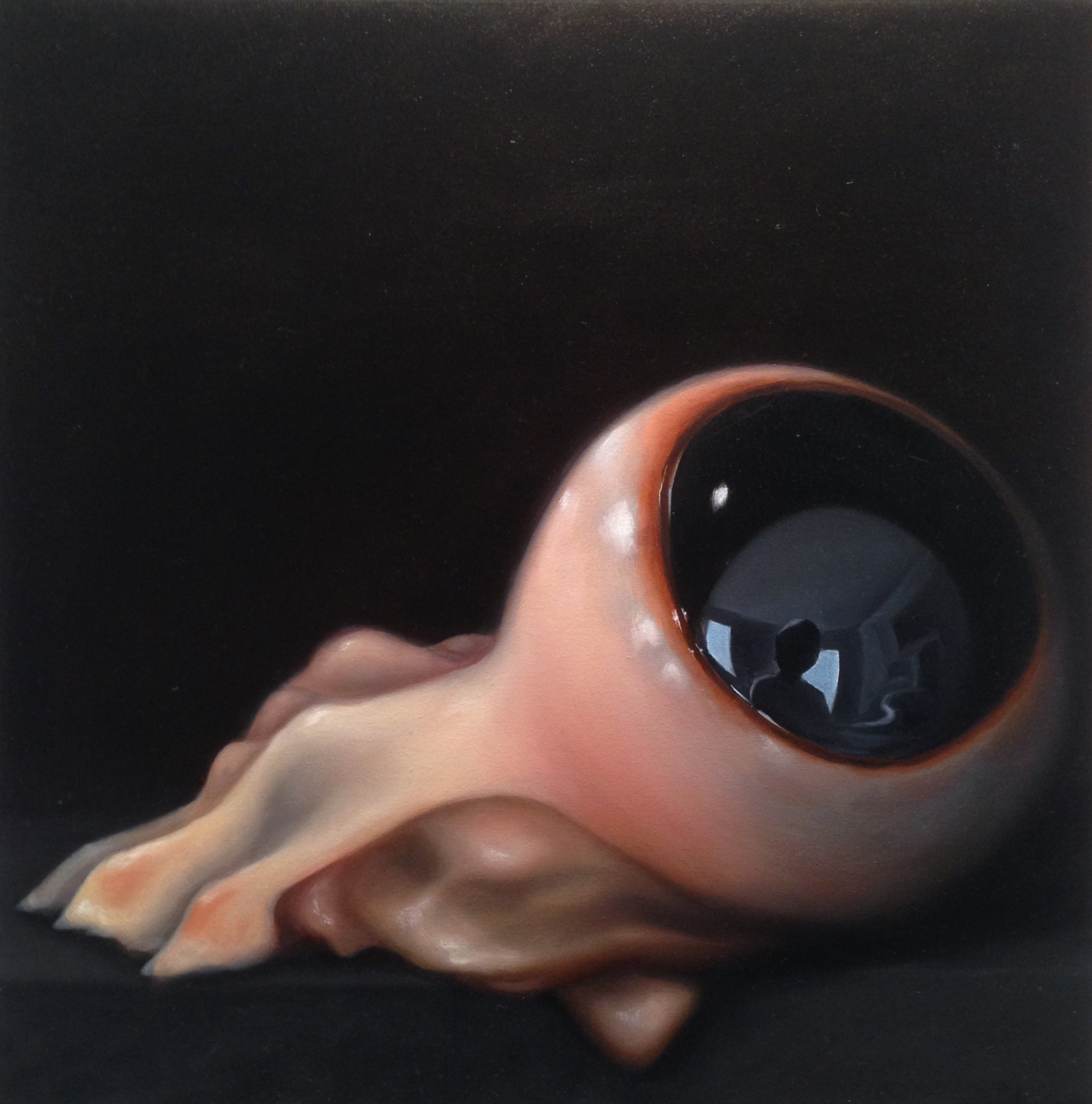 Eye