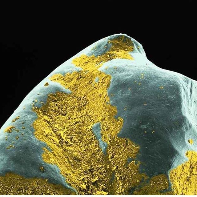 Battle of the bacterial biofilm! How cool is this view of the surface of a tooth from an electron microscope? 📸 Unknown