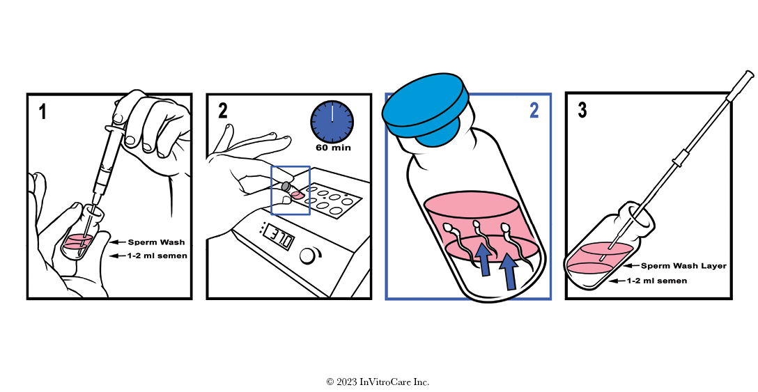 SIMPLY IUI™ — InVitroCare Inc