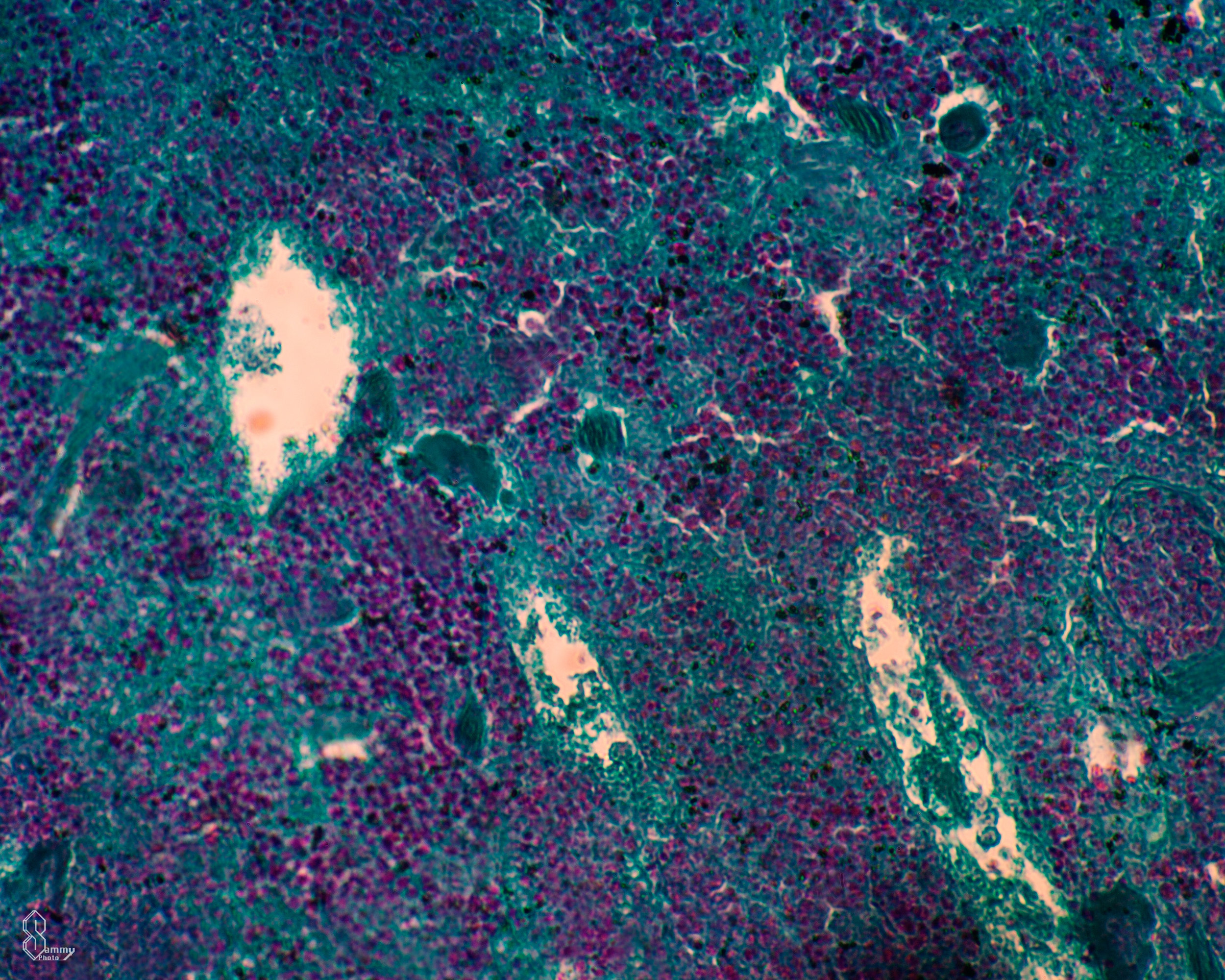  THC,&nbsp;Santa Barbara, California, Under the microscope.  More info.&nbsp;  