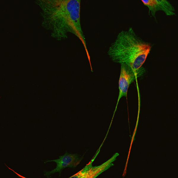 " Exodus is a photographic exhibition of cells grown from human skin. Cell biologists have discovered how to transform normal skin cells into embryonic stem cells. I grew these transformed cells in a petri dish and fed them a liquid diet that allowed them to become neural stem cells, and then brain cells like neurons and astrocytes. Using fluorescent antibodies, I stained the cells to allow visualization of their internal skeletons. " - Radha Chaddah