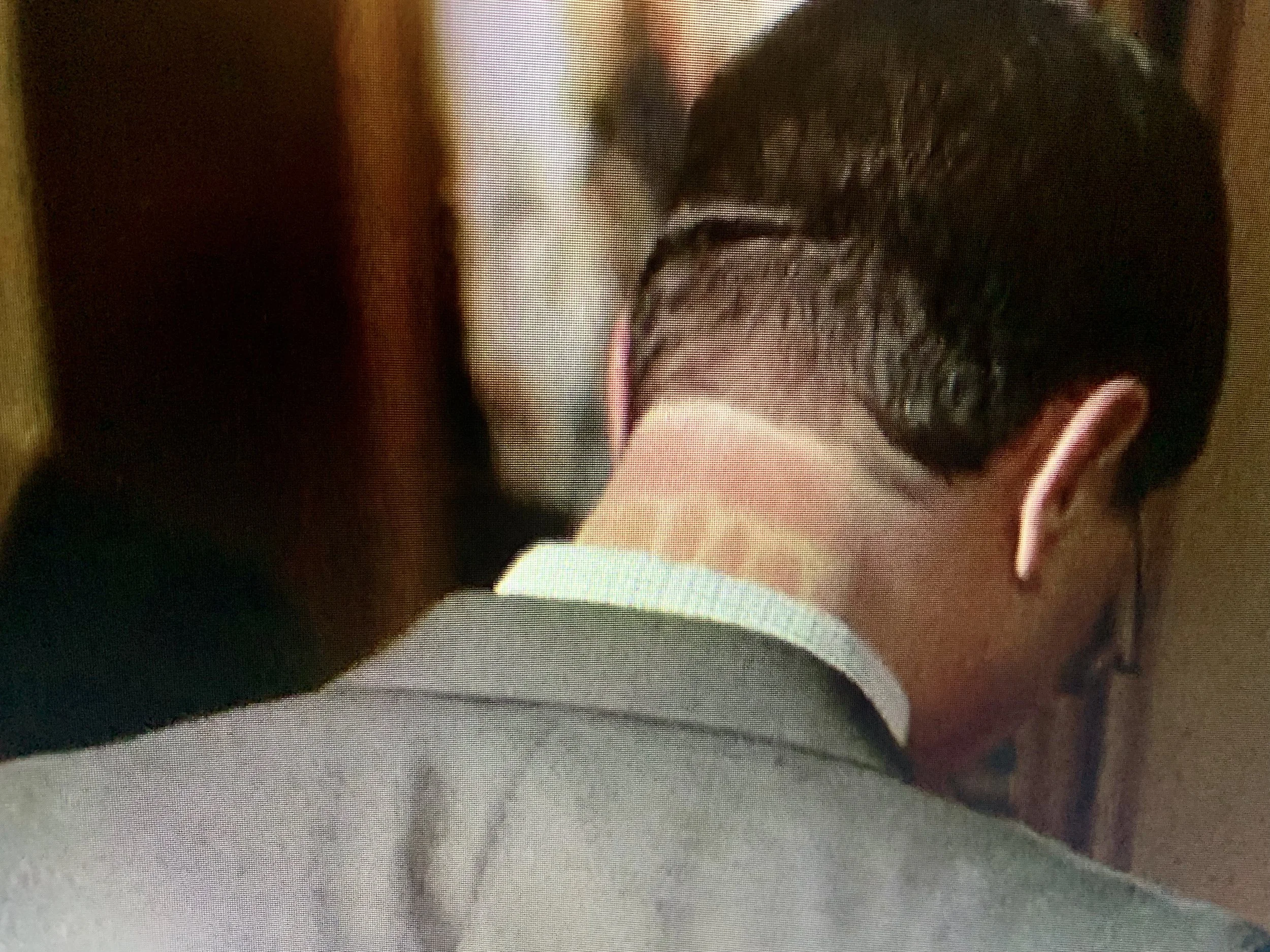 Josh’s inexplicable neck markings