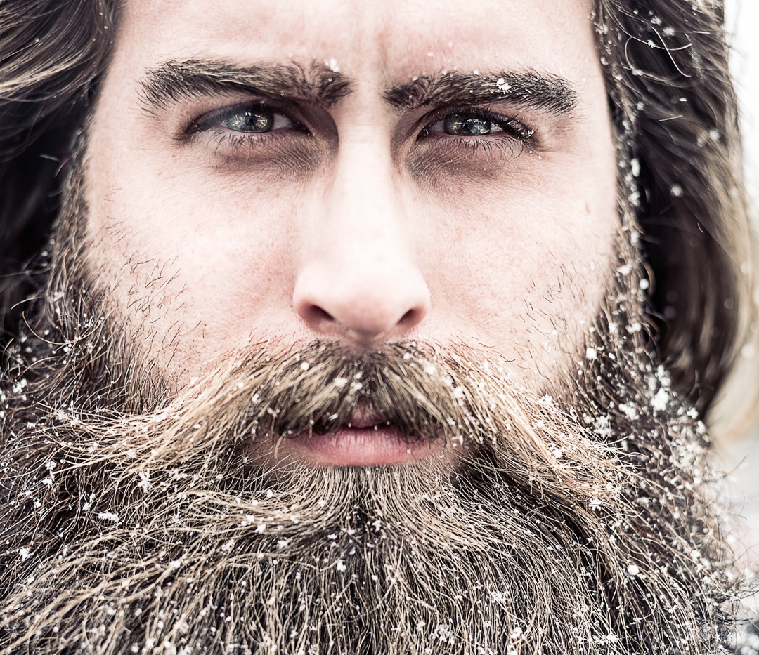 Okay, that's snow, not beardruff, but you get the idea.