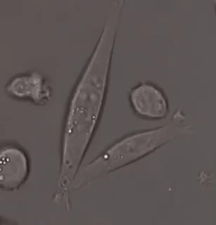 granulocytes kill cancer.gif