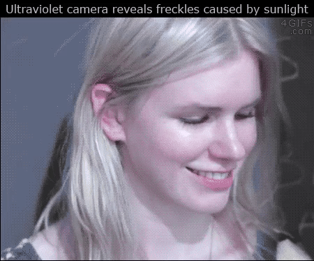 UV+sun+damage.gif