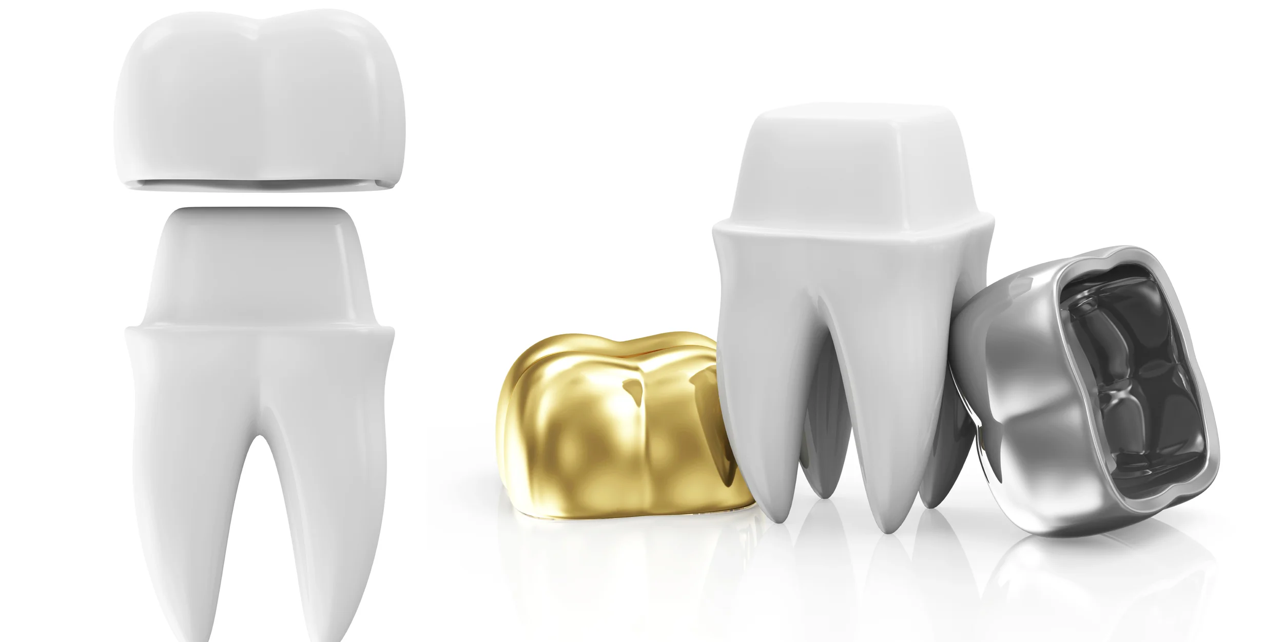 Different Types of Crowns