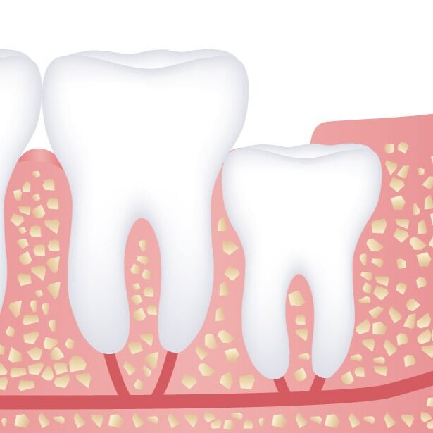 molars-partial.jpg