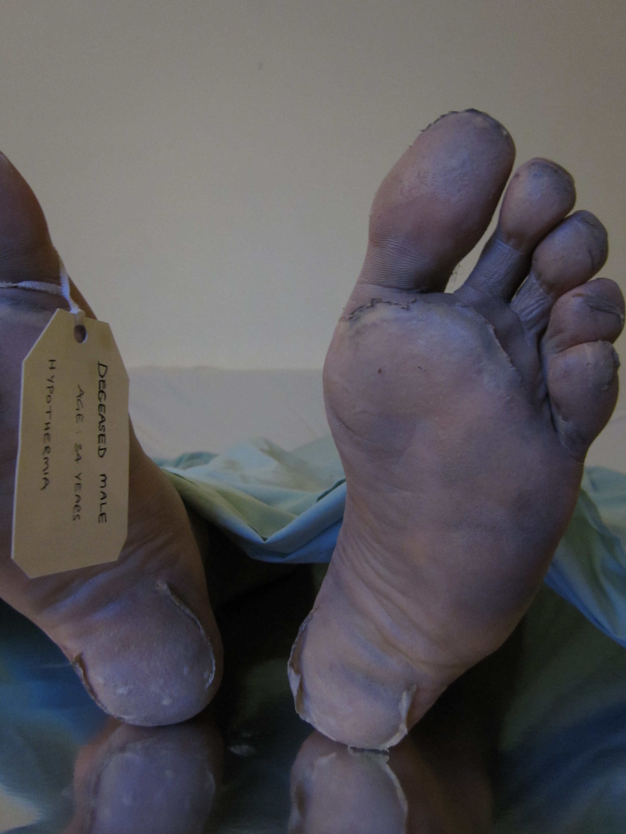 body in a morgue