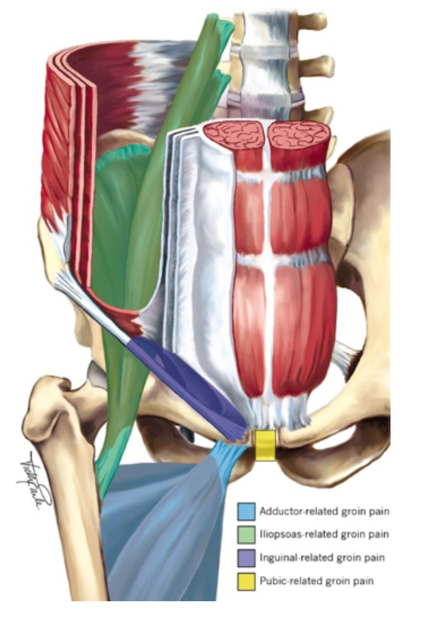 Get Back In The Game Athletic Groin Pain Explained Jenkins Physio Blog