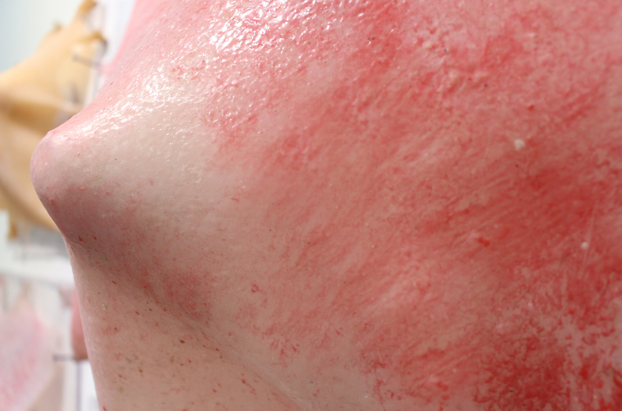 Stretched Skin Detail 2.jpg