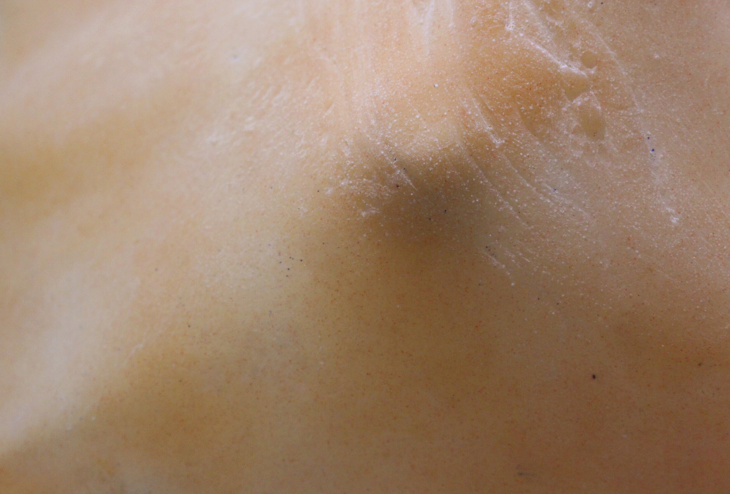 Stretched Skin Detail.jpg