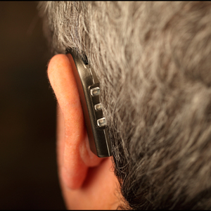 Wearing hearing aids corrects hearing loss as well as a common underlying cause of tinnitus