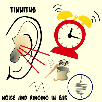 Werkloos Pakistan Vermeend Tinnitus: Ringing or Whistling Noise in Ears — Quadio