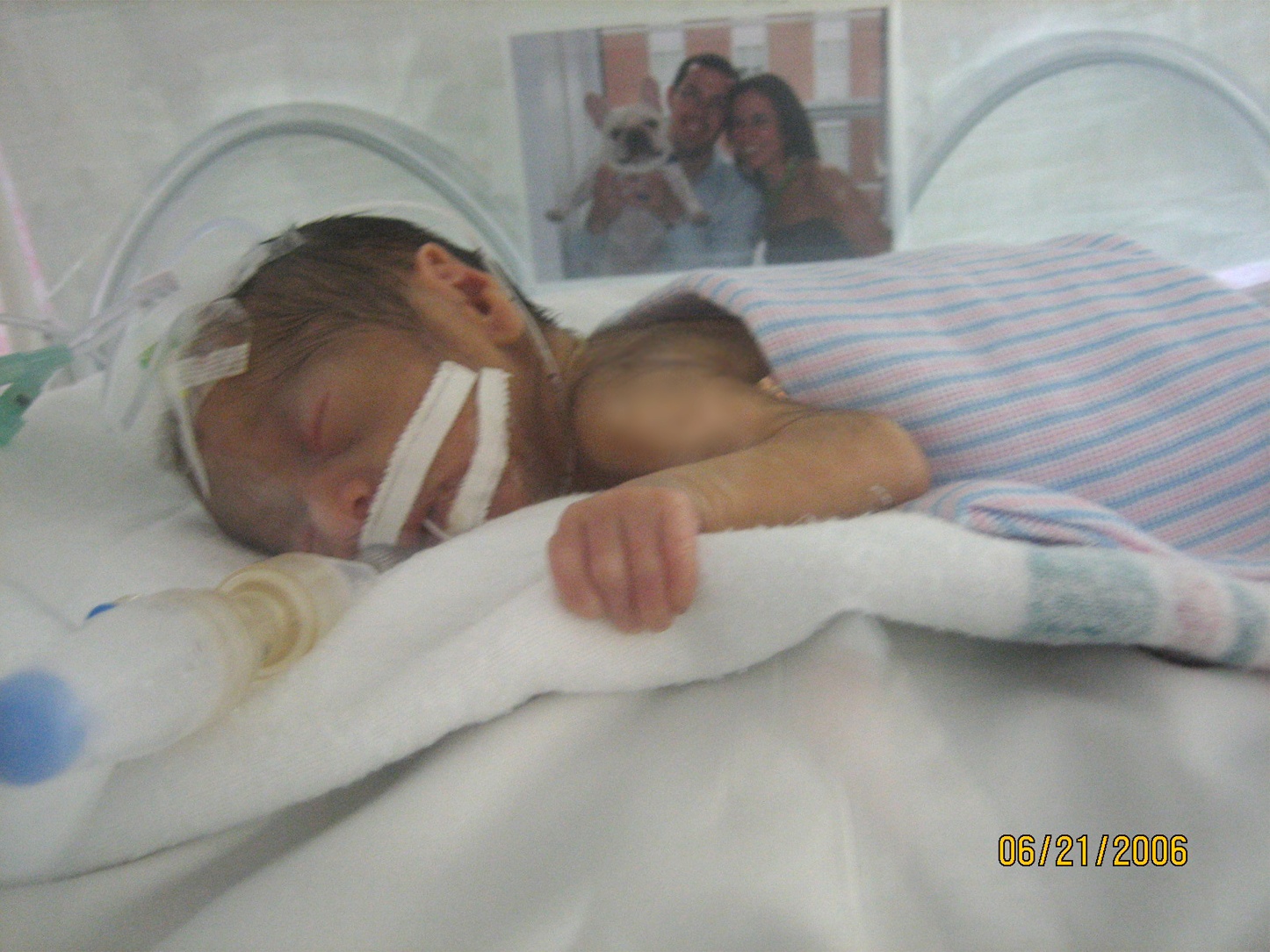 Isabelle in her isolette (2 weeks old)