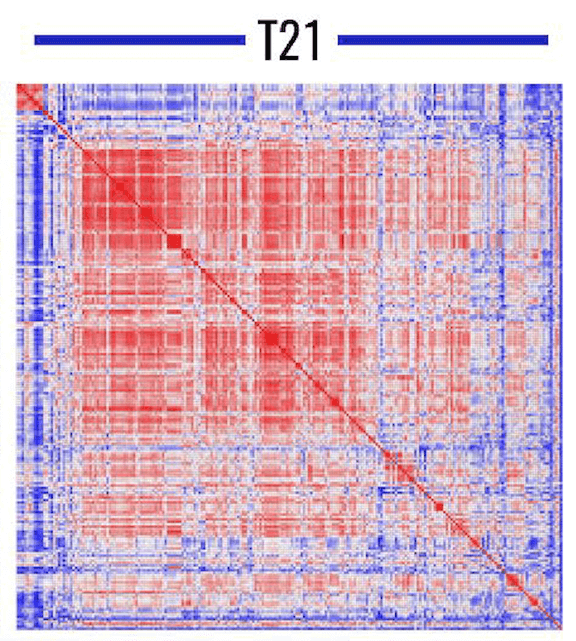Heatmap showing correlations between metabolites in trisomy 21 red blood cells (blue to red indicates correlations of -1 to 1, respectively).