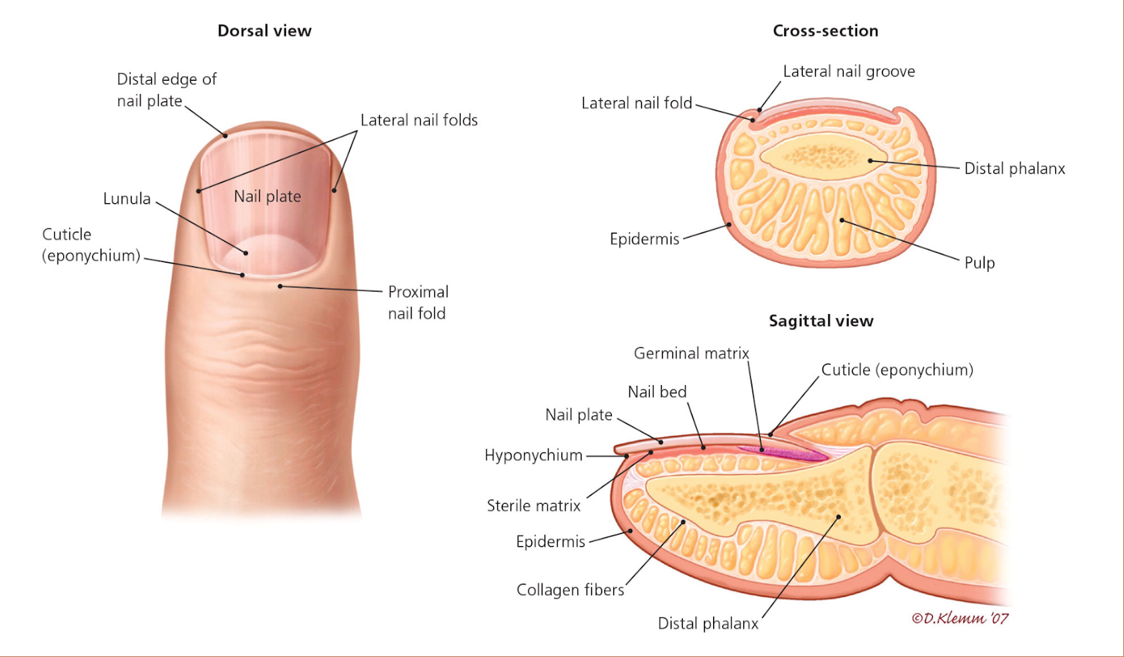 Approach to Evaluation and Management of Traumatic Finger Amputations ...