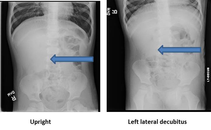 Figure 1: Abdominal Xrays