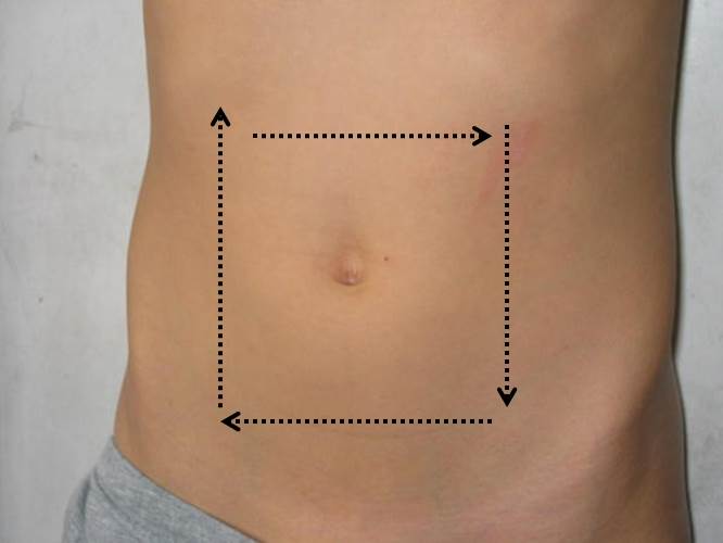 Figure 6:&nbsp;Ultrasound technique