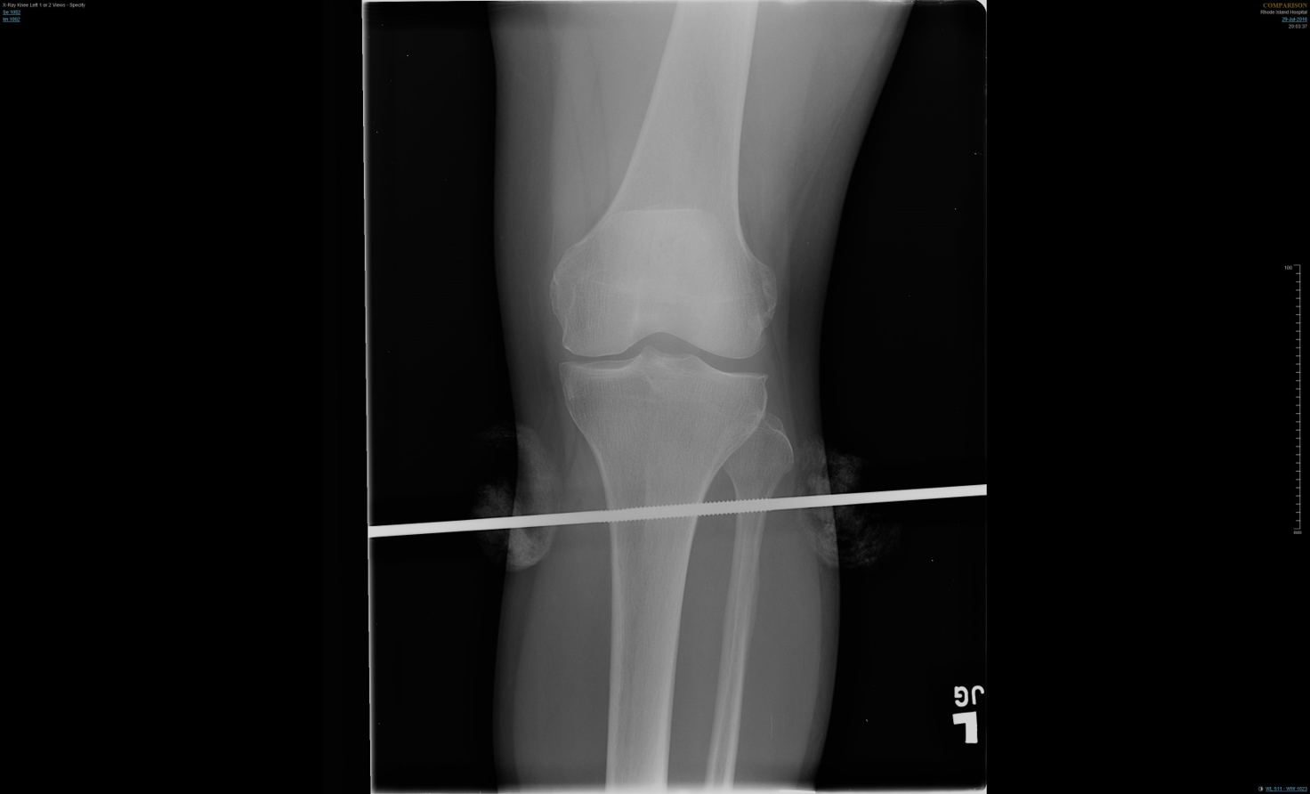 Figure 5: Confirming proper pin placement 