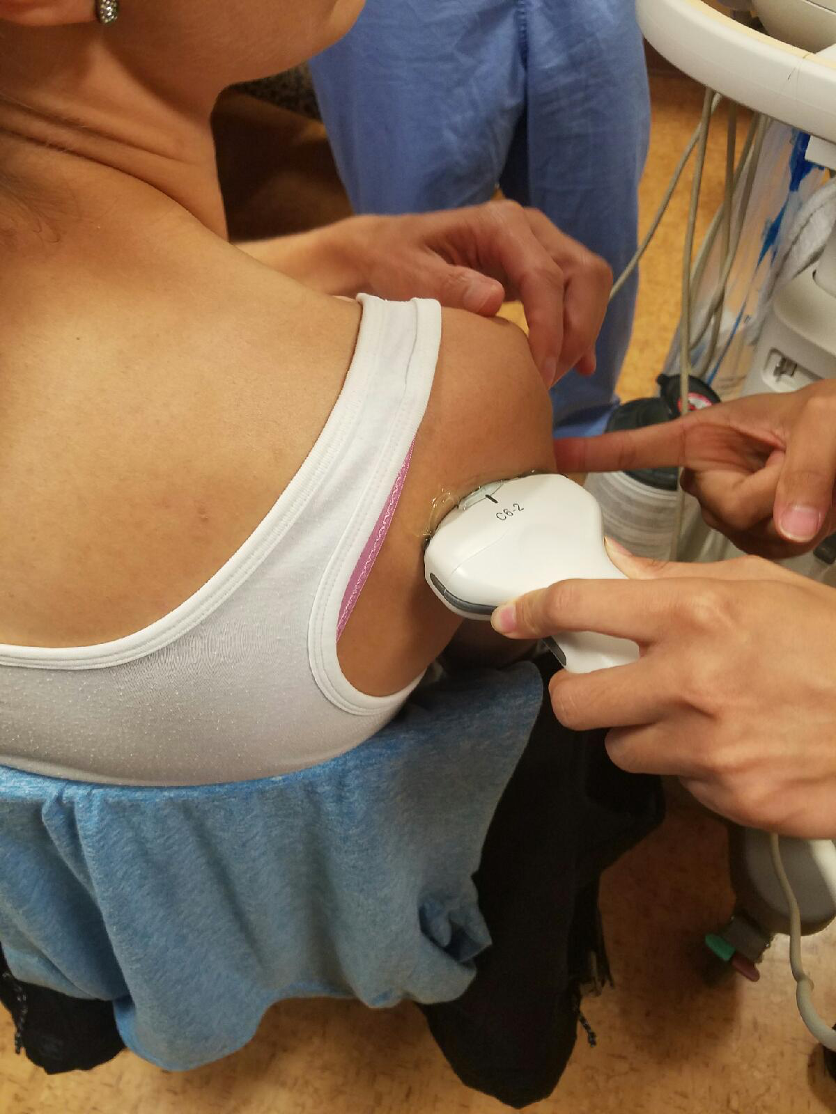 Figure 8: Representation of intra-articular lidocaine injection