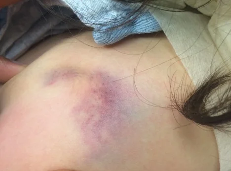 Image 1: Physical examination findings 