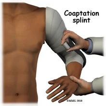 Image 5: Coaptation splint