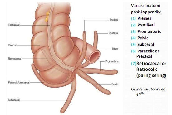 Figure 7: Photo source: http://cephalicvein.com/wp-content/uploads/2016/08/appendix-location-dr-herry-setya-yudhautama-spb-finacs-mhkes-ics-digestive.jpg