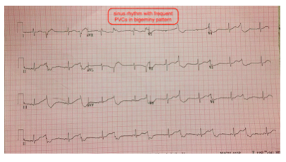 This was the prehospital EKG