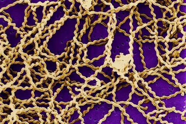 Figure 3: The spirochetes of the genus Leptospira. Source: Health and Fitness Tips Blog, 2012.