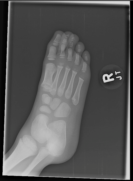 Oblique Right Foot XR.png